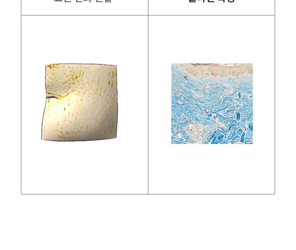 [주름리프팅] 퍼셀 82% 하이-도즈 펩타이드 콜라겐 앰플 20ml 상세페이지 26